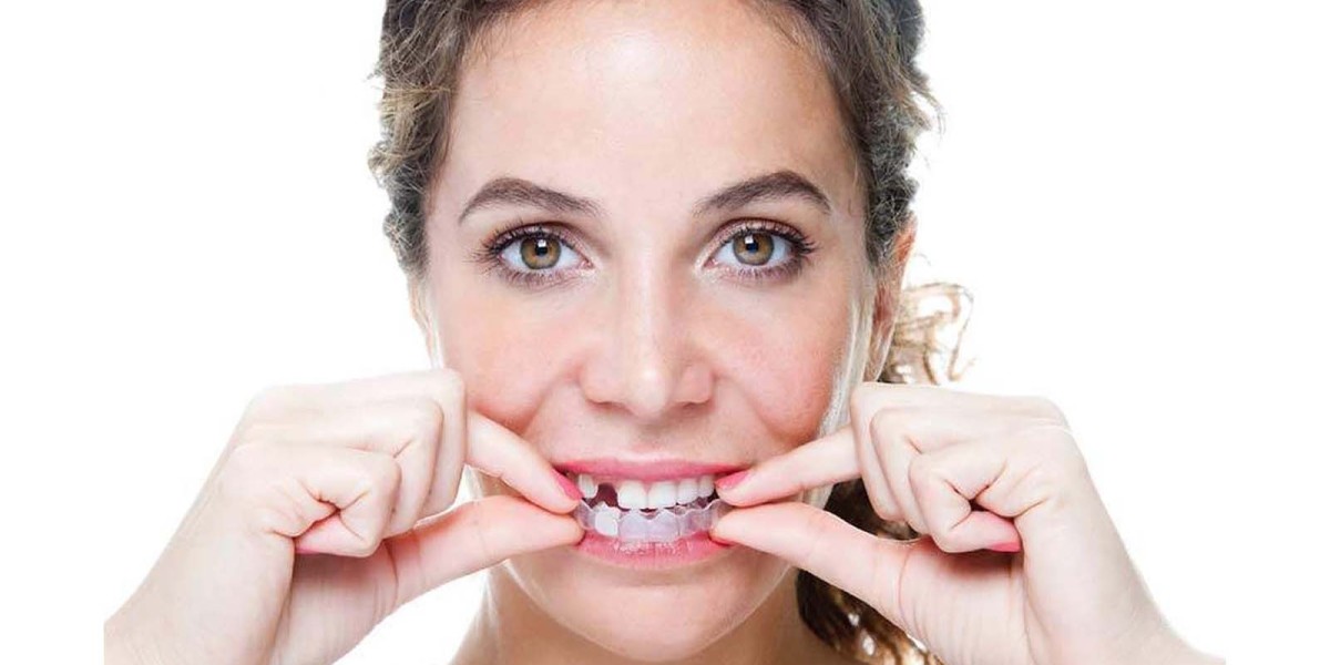 Affordable Cosmetic Dentistry Dubai Options