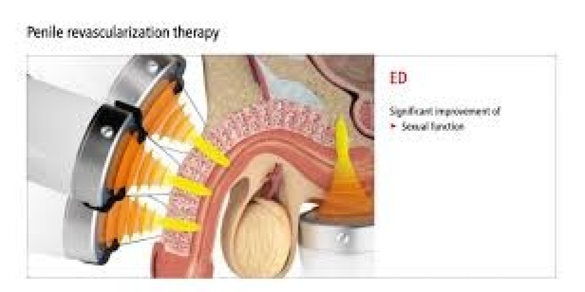 How Erectile Dysfunction Treatment in Dubai Helps Restore Confidence and Improve Quality of Life