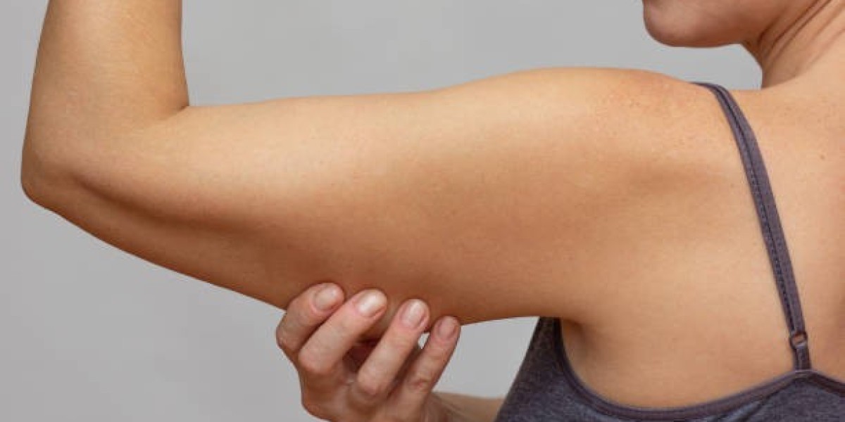 What Makes Arm Lift Surgery So Effective?
