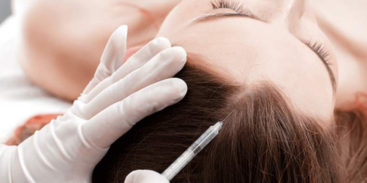 GFC Hair Treatment for Hair Regrowth: Benefits, Process, and Results