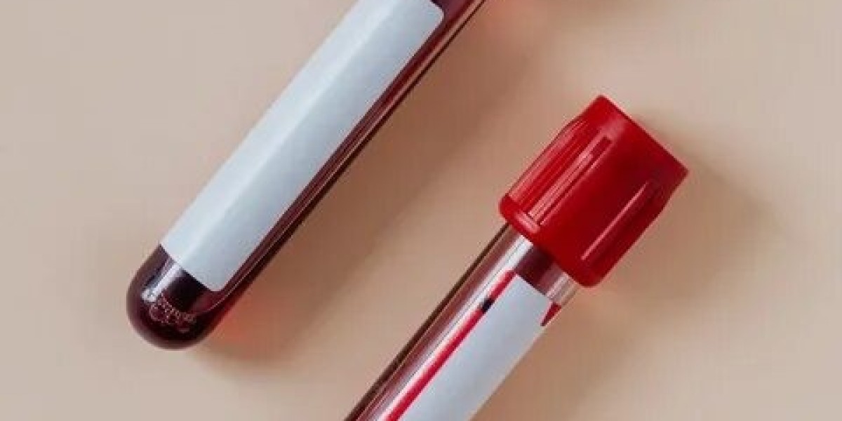 How Accurate Is a Pregnancy Blood Test?