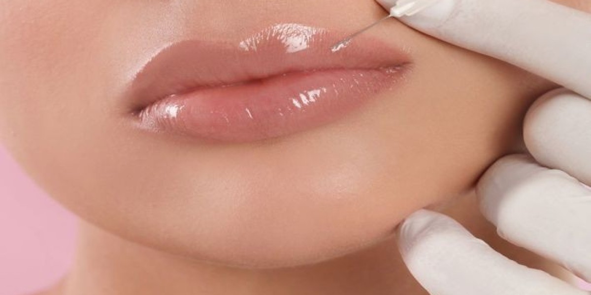 Volbella Fillers For Lip in Dubai: Natural Enhancement for Soft, Beautiful Lips