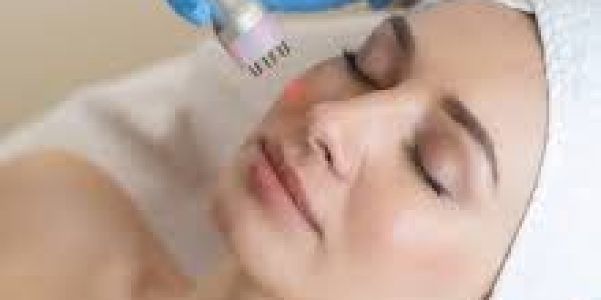 Endolift Treatment in Dubai for Natural Skin Tightening and Facial Rejuvenation