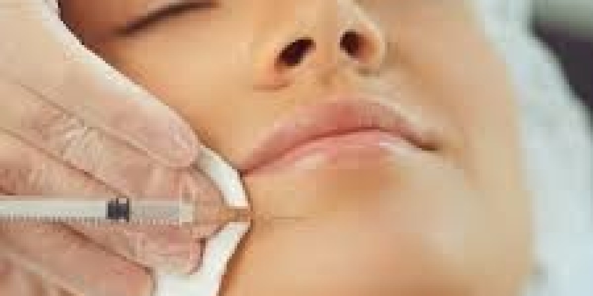 How Cheek Filler Injections in Dubai Restore Facial Balance