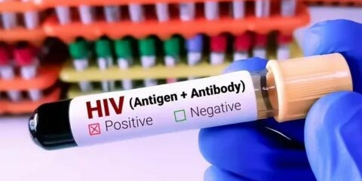 HIV Blood Test Preparation: Essential Tips Before Testing