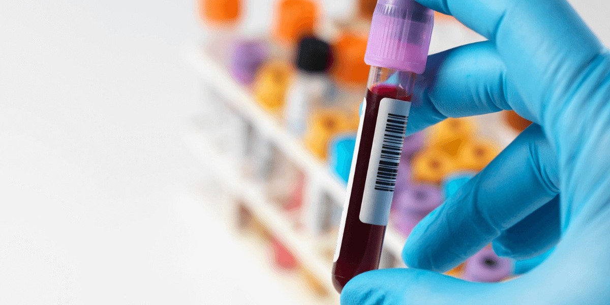 Visa Blood Test Procedures: A Beginner’s Guide