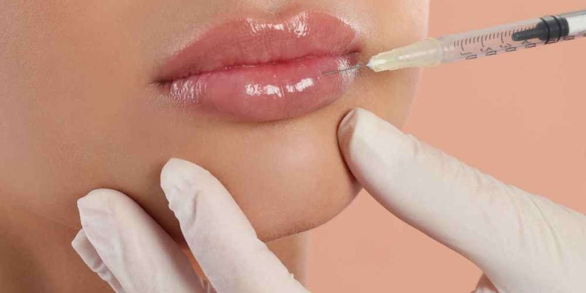 Russian Lip Filler in Dubai: Advanced Filler Techniques