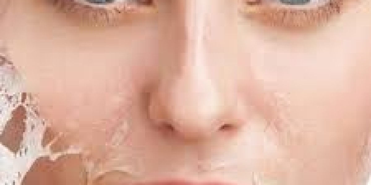 Chemical Peel in Dubai for Youthful and Radiant Skin Renewal and Glow
