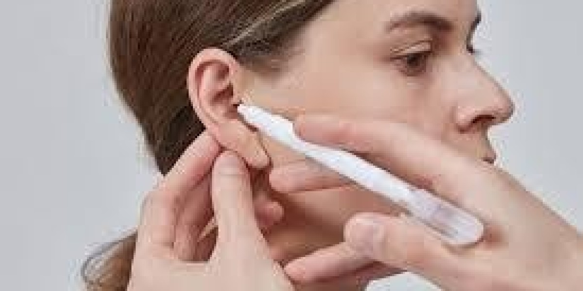 What age is best for Otoplasty surgery?