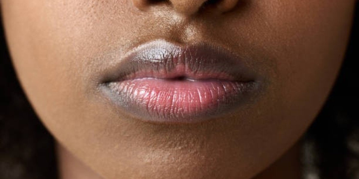 Best Oils for Treating Smoker’s Lips Naturally