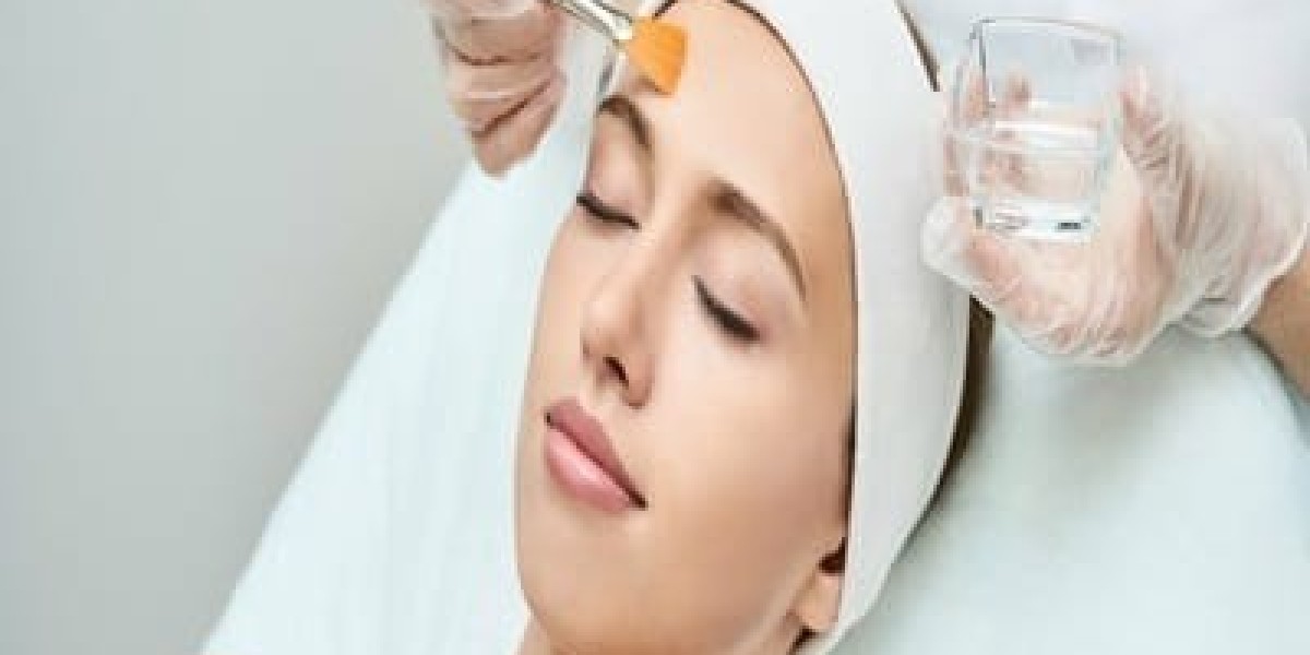Chemical Peels in Dubai for Acne Scars and Skin Renewal