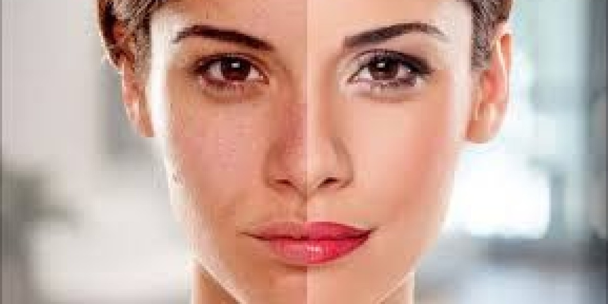 Cutting-Edge Dermatology Skin Brightening Treatments for Radiant, Even-Toned, and Healthy Skin Glow