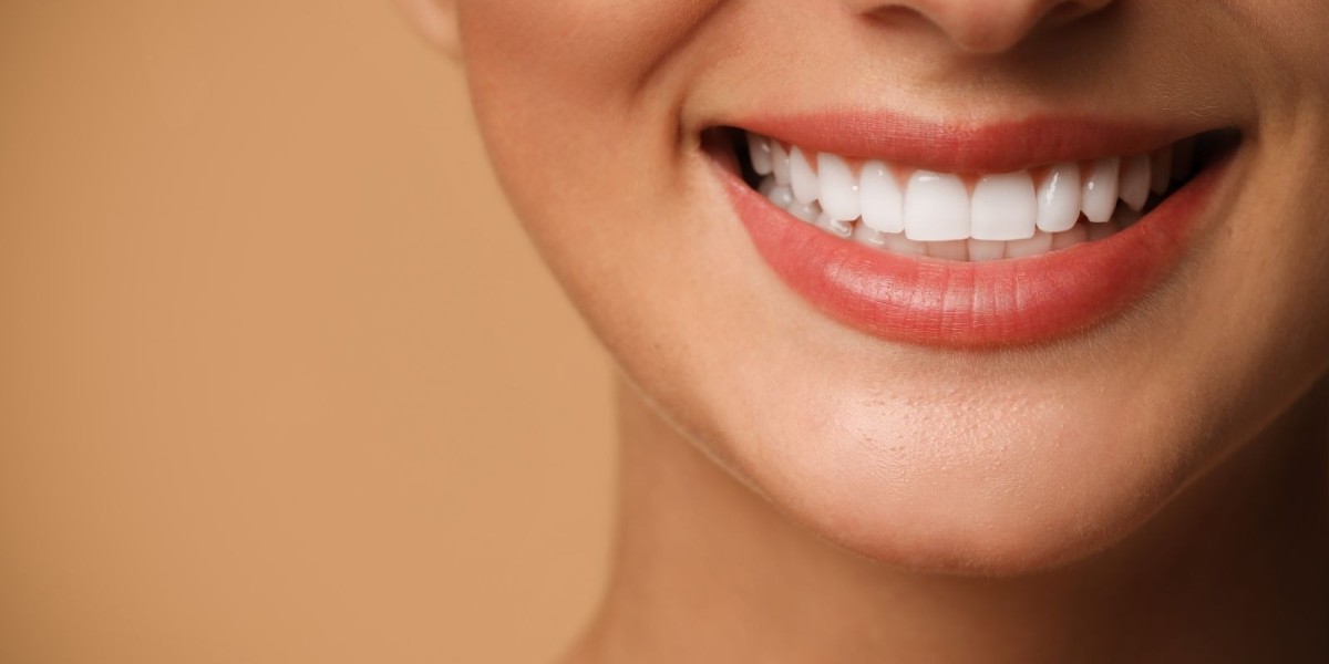 Teeth Whitening Dubai: A Complete Patient Guide