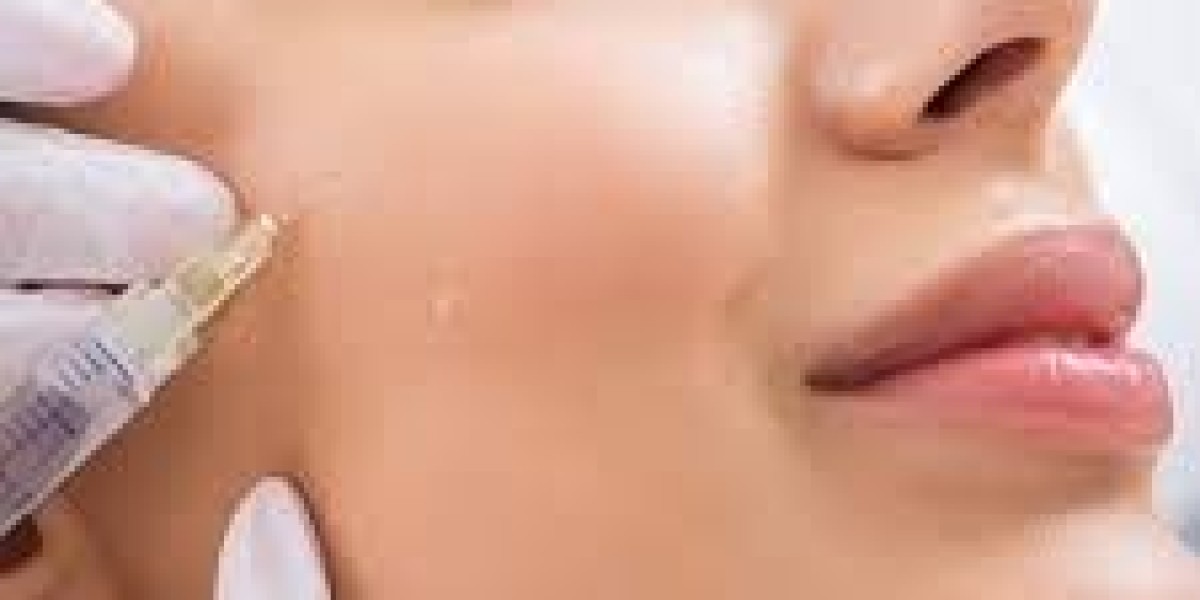 Cheek Filler Injections in Dubai for Natural Facial Contouring and Youthful Volume