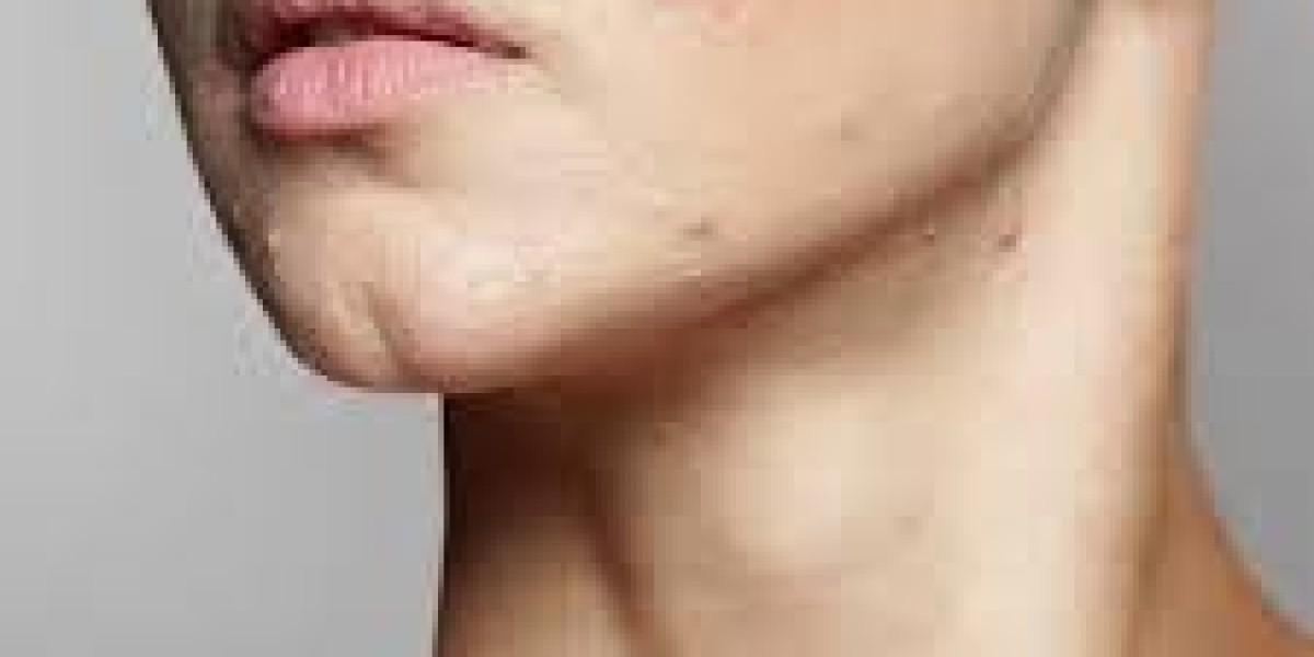 Advanced Scar Removal in Dubai for Clear, Smooth, and Healthy Skin