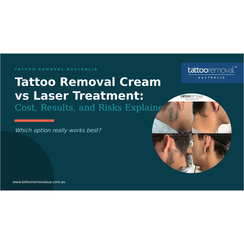 Tattoo Removal Cream vs Laser Treatment: Cost, Results, and Risks Explained