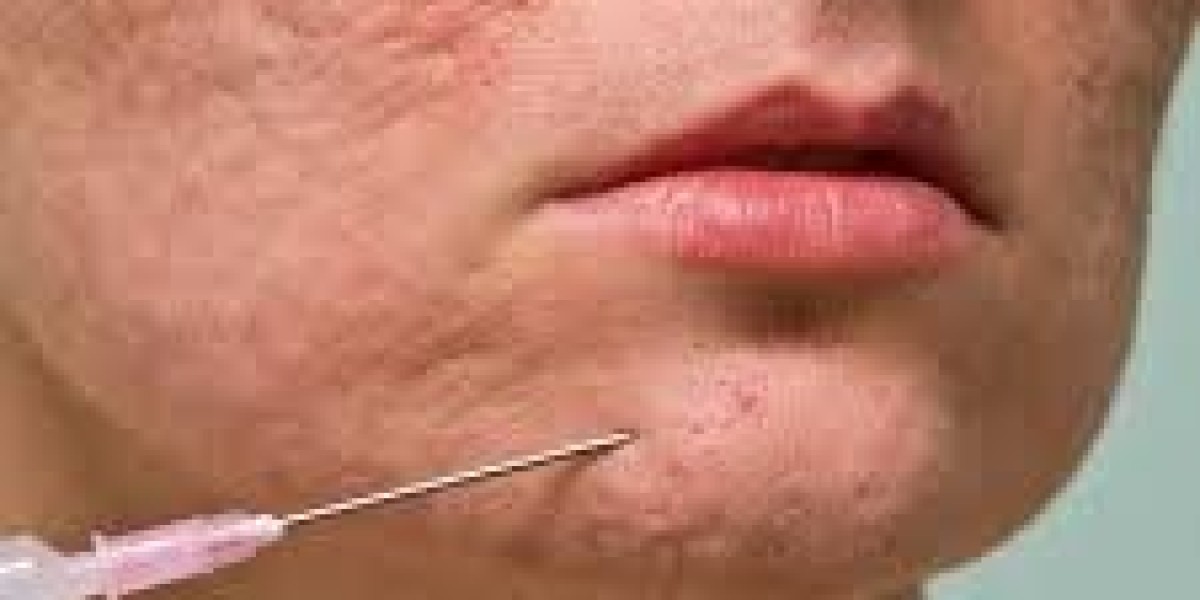 Scar Removal in Dubai: Modern Solutions for Clear and Smooth Skin