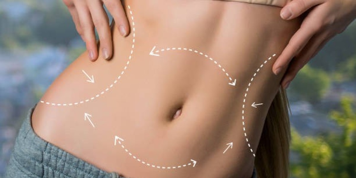 Myths and Facts About Body Sculpting Treatments