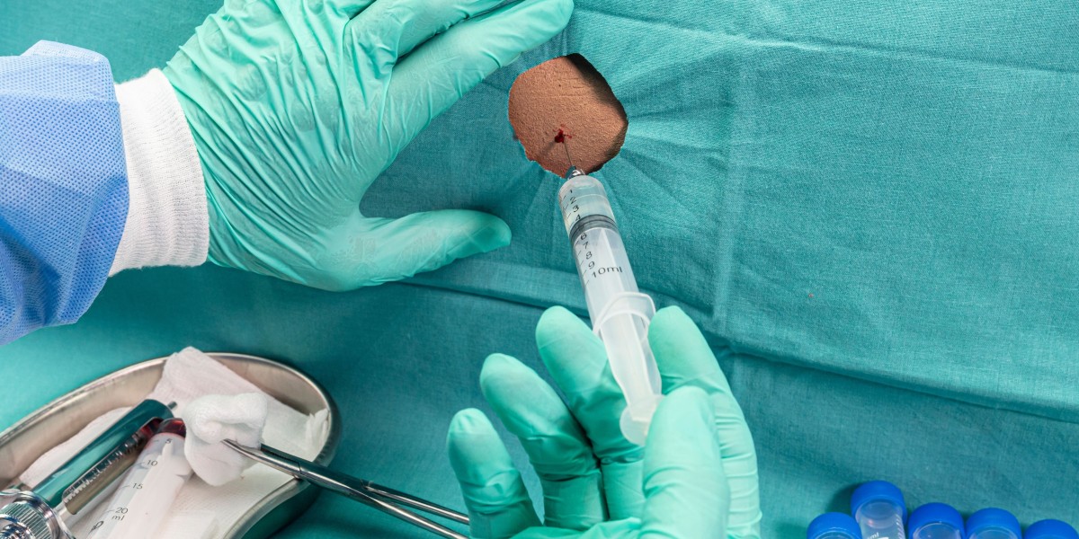 Powerful guide Biopsy for Diagnosis Purposes for lab precision