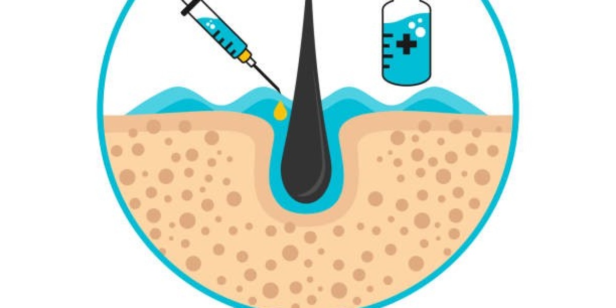 How Hard Water Exposure Damages Hair and Scalp Health PRP Hair Treatment in Islamabad: