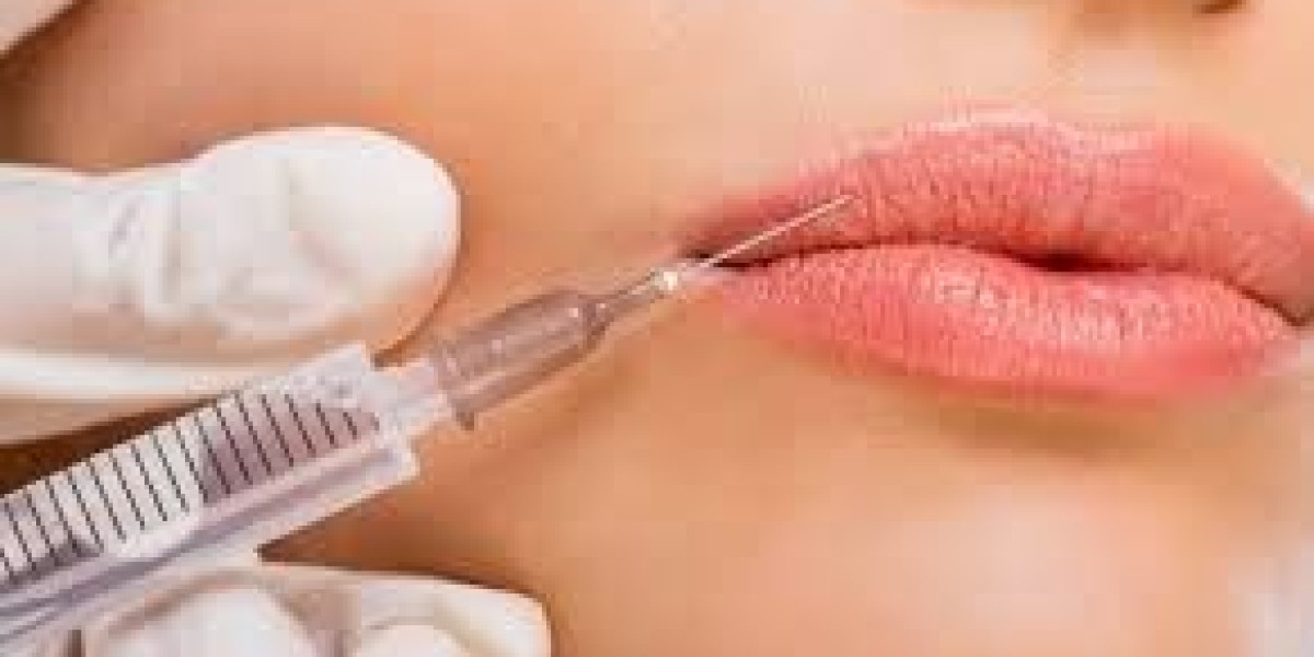 Dermal Fillers in Dubai – Modern Facial Rejuvenation for Natural Youthful Beauty