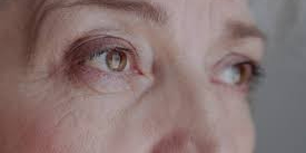 How Lifestyle Choices Affect Fine Lines and Wrinkles in Dubai