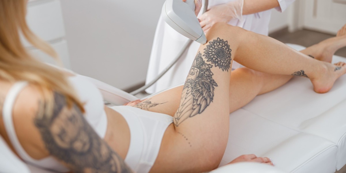 Laser Tattoo Removal Creates New Possibilities For Skin