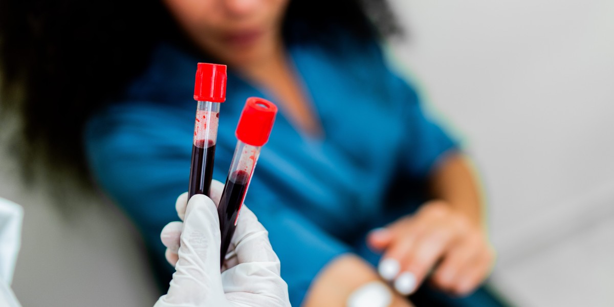 Full Blood Test for Early Disease Detection: Facts and Benefits