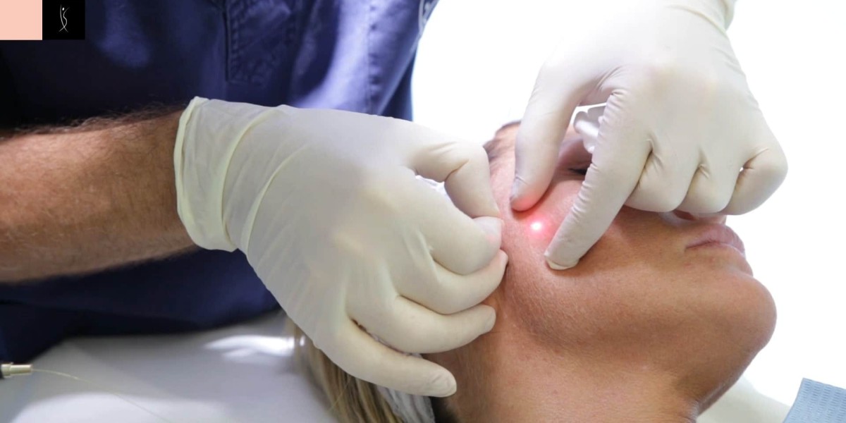 Fractional C02 Laser Treatment glowing stellar pore glow smooth glamor