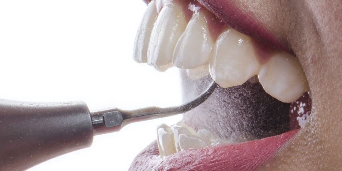 Best Dental Clinic in Abu Dhabi – Your Guide to Quality Dental Care