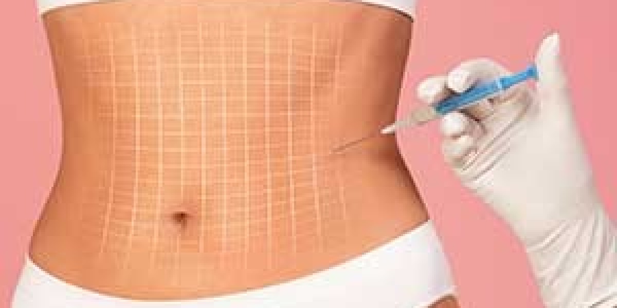 Fat Melting Injection in Dubai: Modern Body Contouring Explained
