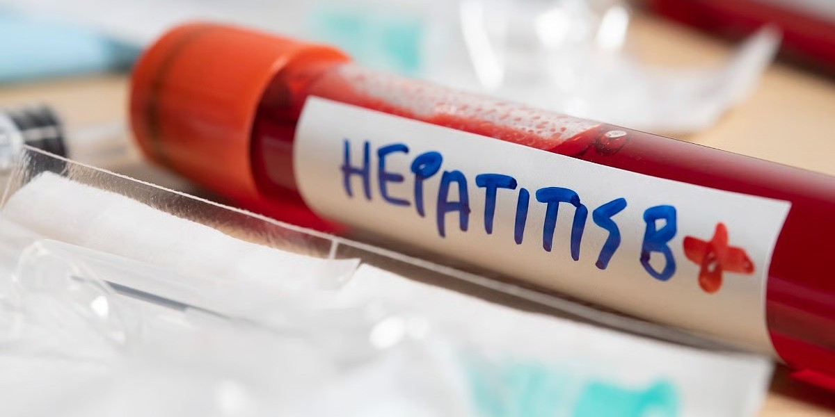 Hepatitis B Test Dubai – Simple, Safe, and Accurate Screening