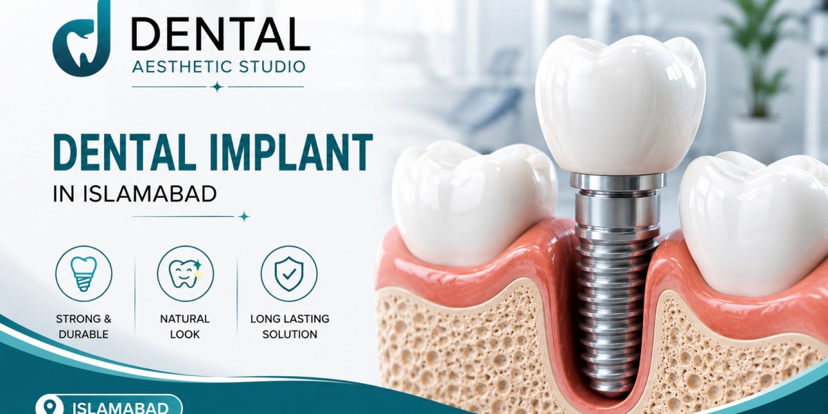 Can your gums reject implants?