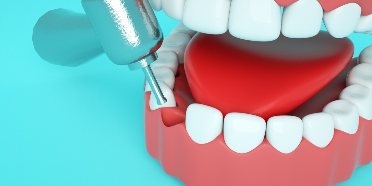 Dental Clinic in Dubai for Gum Disease Treatment