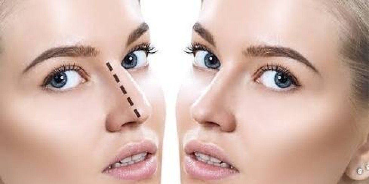 Best Nose Surgery Cost in Dubai Services for Seniors