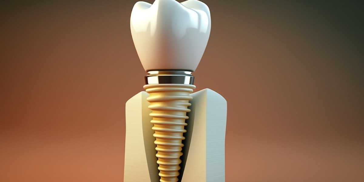 Dental Implants in Dubai: Step-by-Step Treatment Process
