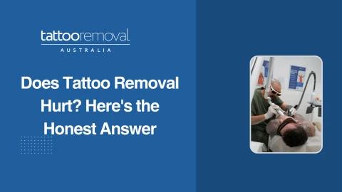 Does Tattoo Removal Hurt Here's the Honest Answer