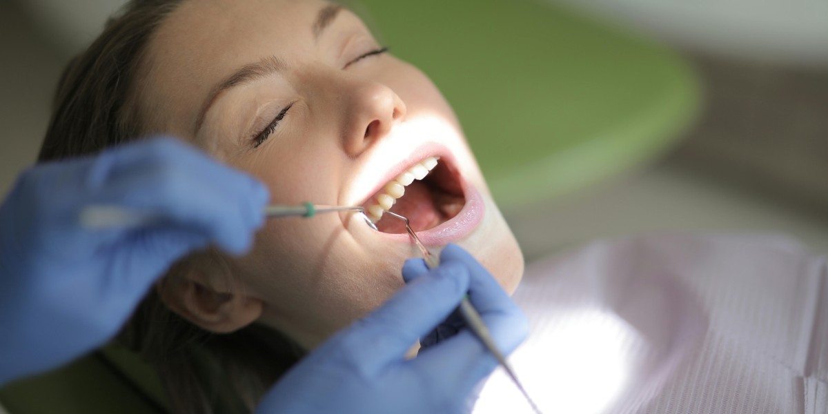 Professional Teeth Cleaning in Ottawa