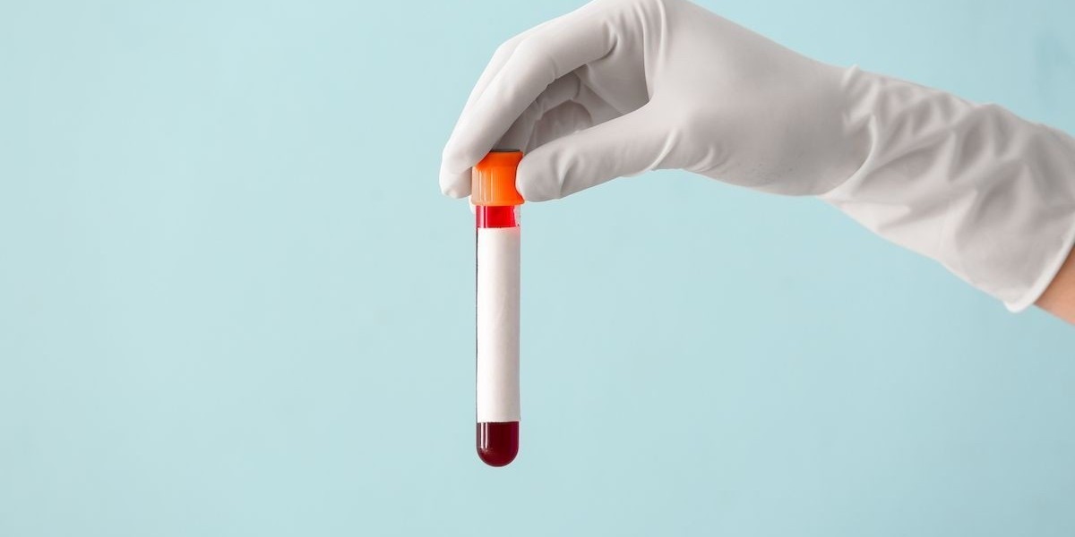 Full Blood Test: Understanding Red and White Blood Cell Counts