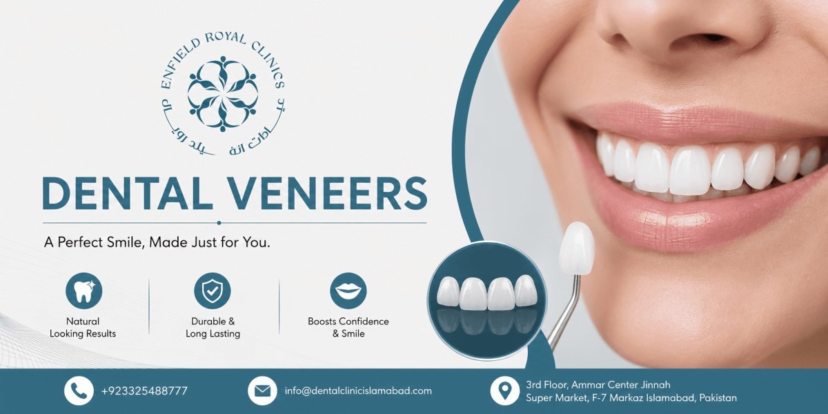 Trusted Dental Veneers in Islamabad for Every Smile
