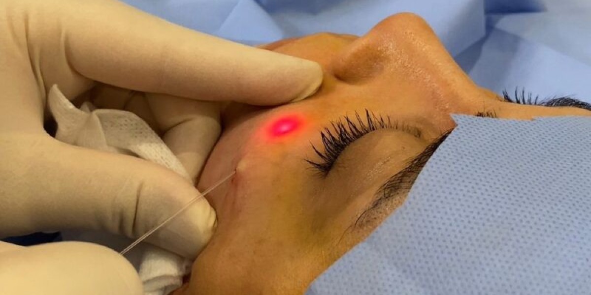 Leading Choices for Endolift in Dubai
