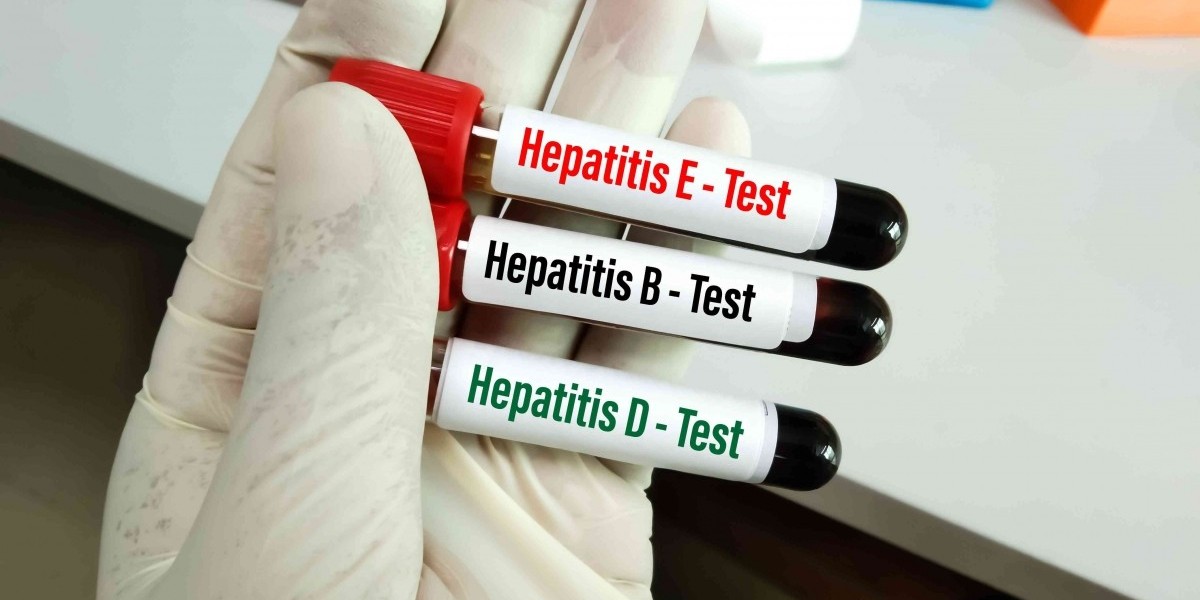 Hepatitis B Test in Dubai for Preventive Healthcare
