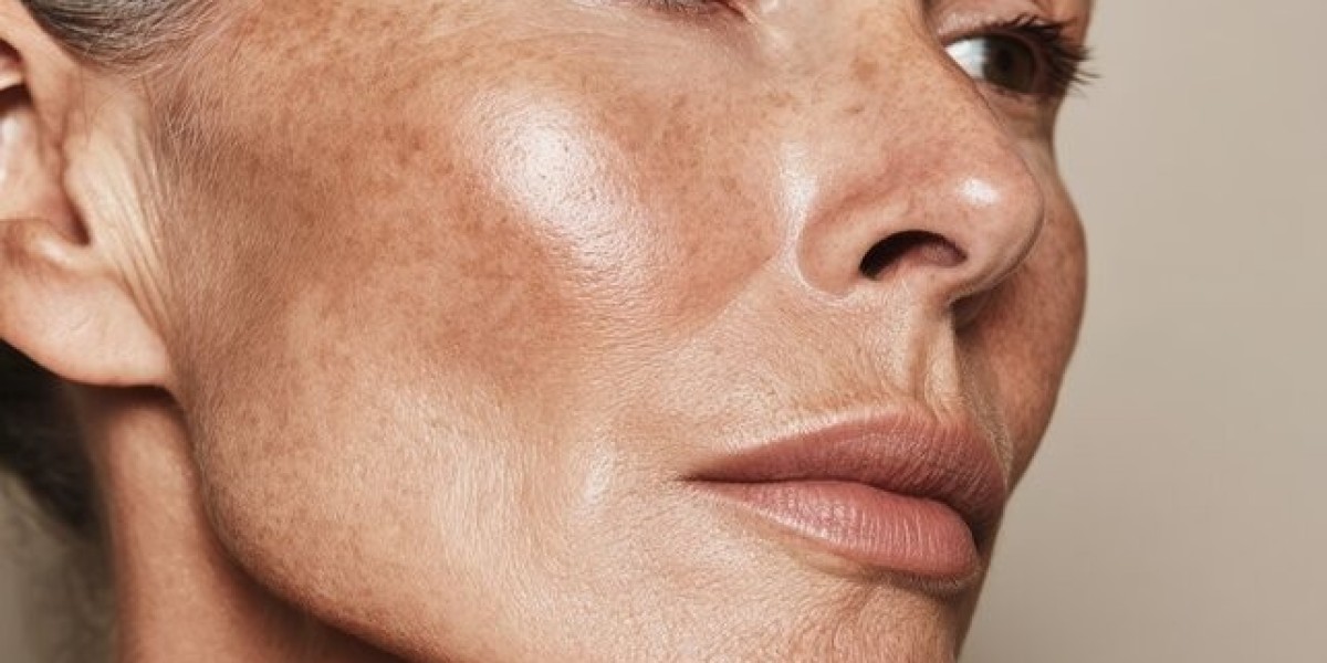 Skin Pigmentation in Dubai: Restore Your Natural Glow