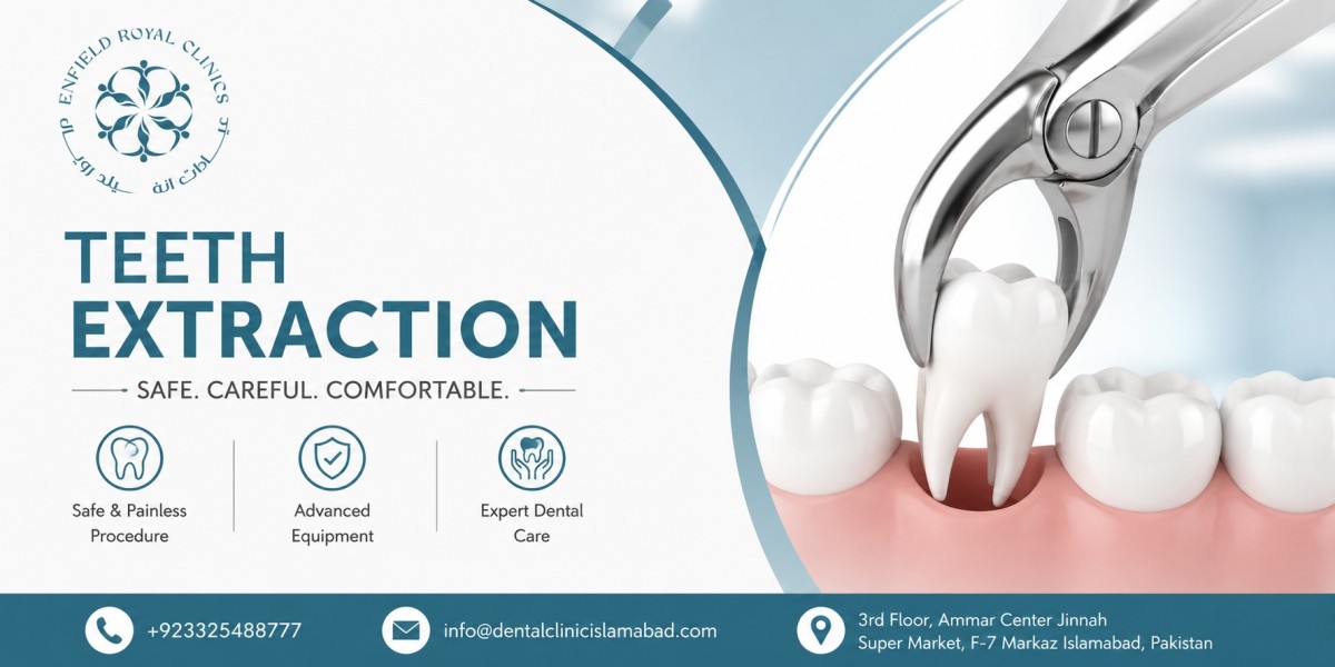 Affordable Teeth Extraction in Islamabad Without Compromising Quality