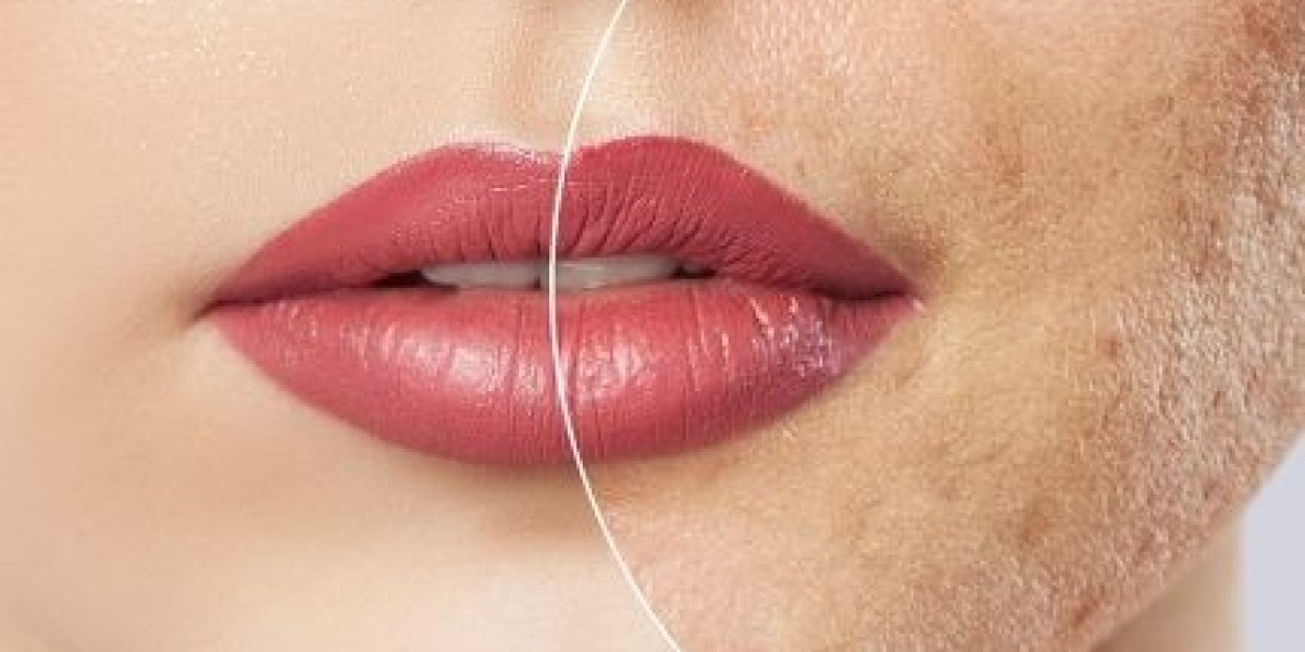 Laser Scar Removal in Dubai: Skin Clarity