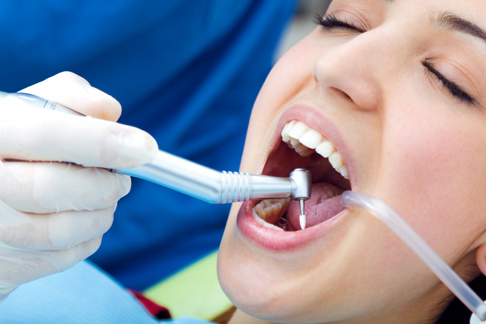Dental Crowns vs Fillings: When Does a Tooth Need Extra Protection?