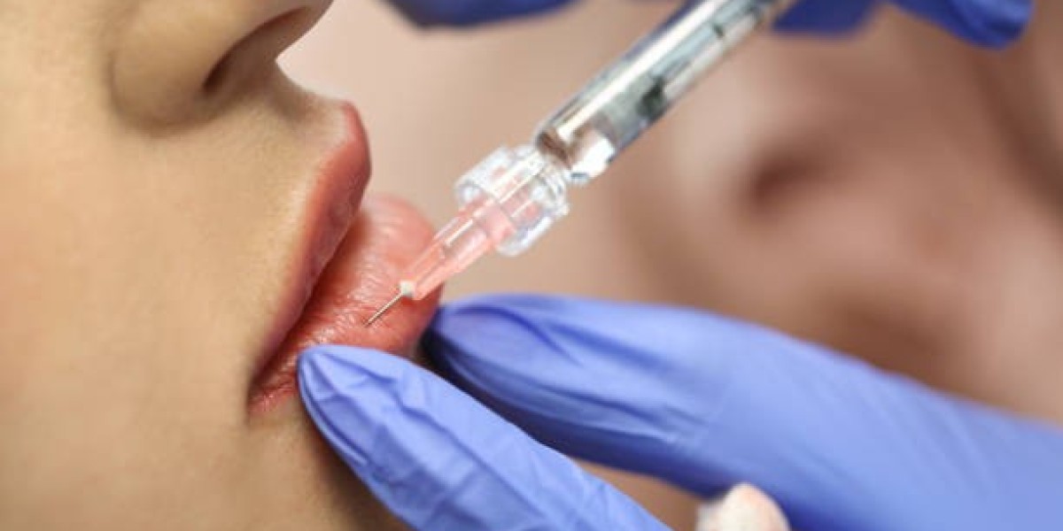 Dermal Filler Mistakes That Cost More to Fix