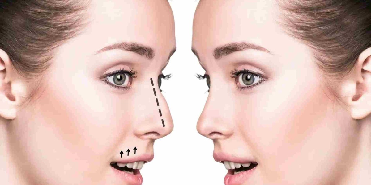 What Determines Your Treatment Plan for Nose Surgery in Dubai?