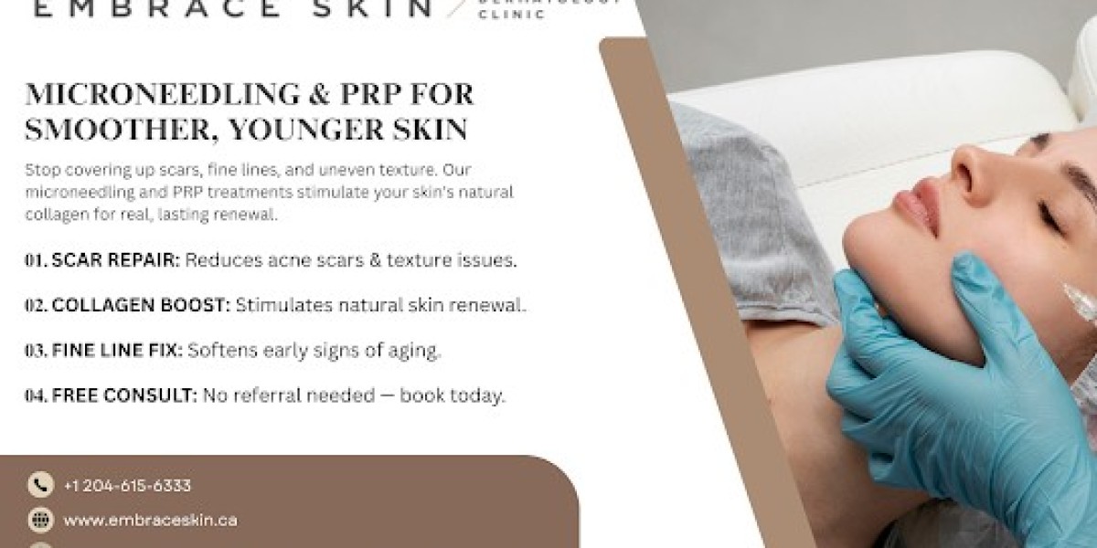The Post-Treatment Question Almost Everyone Asks After Their First Microneedling Appointment