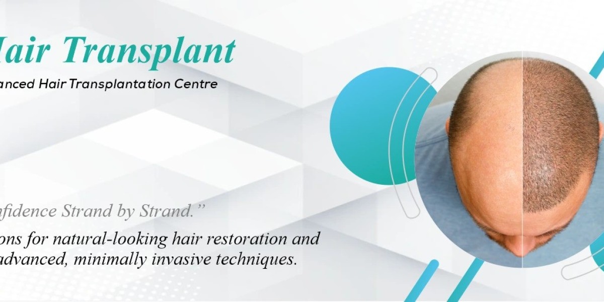 Recovery Tips After FUE Hair Transplant